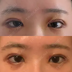 水の森美容クリニック 水の森美容クリニック 横浜院口コミ