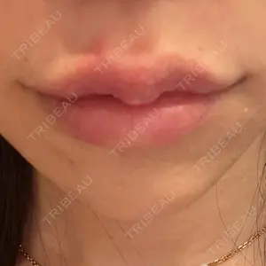 PRO CLINIC プロクリニック 銀座院口コミ