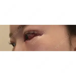 藤・ナチュレ美容クリニック 藤・ナチュレ美容クリニック 銀座院口コミ