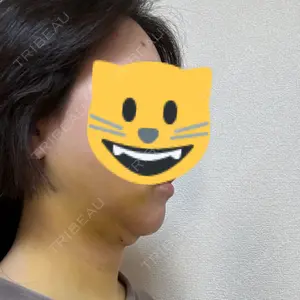 口コミ