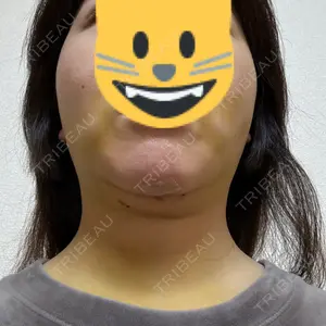 口コミ