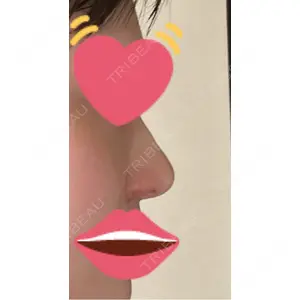 リッツ美容外科の口コミ