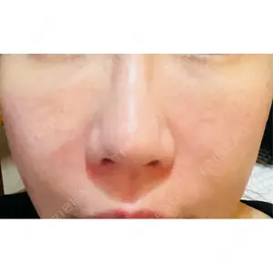 B-LINE CLINIC 池袋院口コミ