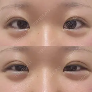 アリエル美容クリニックの口コミ