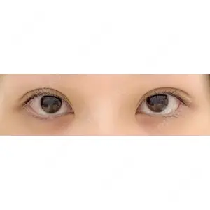 HAAB×DREAM BEAUTY CLINIC HAAB×DREAM BEAUTY CLINIC 大阪梅田院口コミ