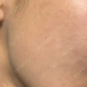 ルラ美容クリニック ルラ美容クリニック 福岡院口コミ