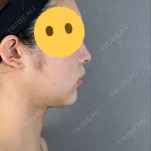 口コミ