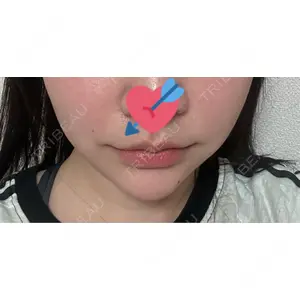 ルラ美容クリニックの口コミ