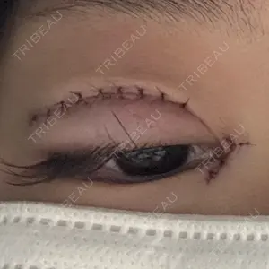 湘南美容クリニック 湘南美容クリニック 札幌院口コミ