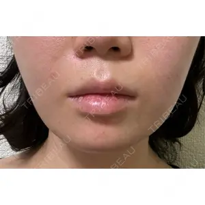 BiBiクリニック口コミ