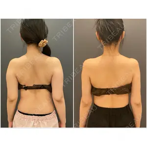オアシス美容外科口コミ
