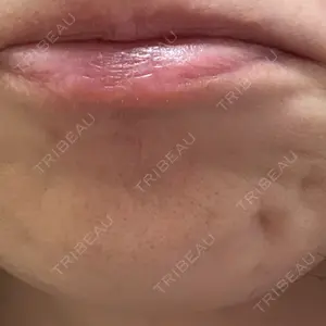 湘南美容クリニック 名古屋栄院口コミ