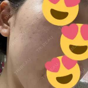 MIO CLINIC 梅田院口コミ