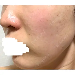 アモーレクリニック 名古屋院口コミ