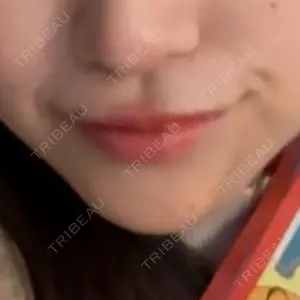 APスキンクリニック銀座口コミ