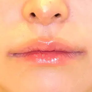 LOUIS CLINIC 二子玉川院【ルイクリニック】口コミ