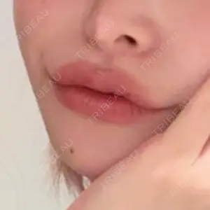 口コミ