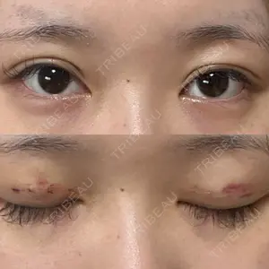 ルラ美容クリニック ルラ美容クリニック 渋谷本院口コミ
