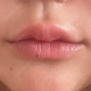 アネシス美容クリニック口コミ