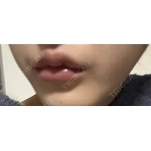 口コミ