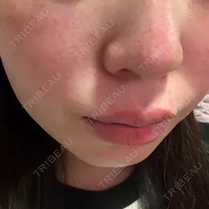 口コミ