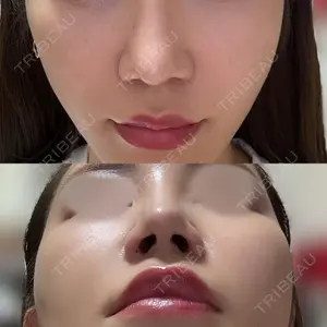 お茶の水美容形成クリニック お茶の水美容形成クリニック口コミ