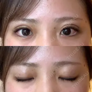 Brandnew Beauty Clinic口コミ