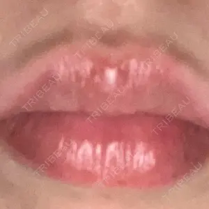 口コミ