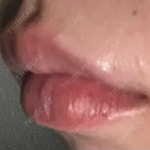 口コミ