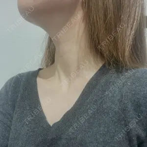 AYANAフィラーズクリニック AYANAフィラーズクリニック 渋谷院口コミ