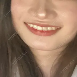 フィラークリニック フィラークリニック 町田院口コミ