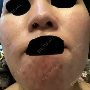 日本美容・医療クリニック 六本木院口コミ