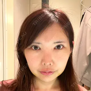 口コミ