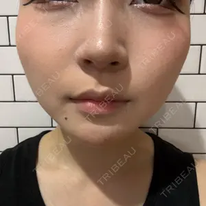 TCB東京中央美容外科 堺院口コミ