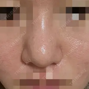 LUHO（ルホ）美容外科口コミ