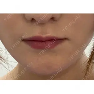 アリエル美容クリニック アリエル美容クリニック 横浜院口コミ