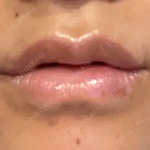 ルラ美容クリニック ルラ美容クリニック 大宮院 / ルラスキンクリニック 大宮院口コミ