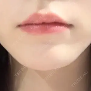口コミ