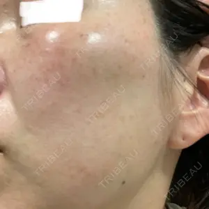 ルラ美容クリニック ルラ美容クリニック 大宮院口コミ