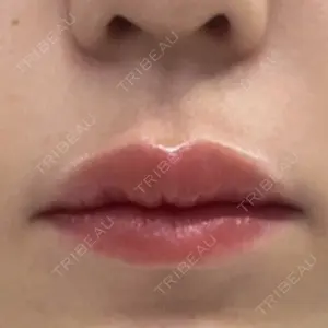 Kinshicho Beauty Clinic （錦糸町ビューティークリニック）口コミ