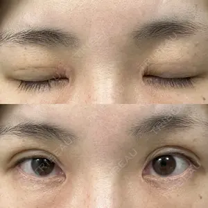 湘南美容クリニック 湘南美容クリニック 千葉センシティ院口コミ