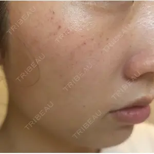 L‘amour clinic Tokyo【ラムールクリニック東京】口コミ