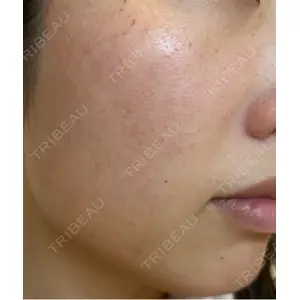 L‘amour clinic Tokyo【ラムールクリニック東京】口コミ