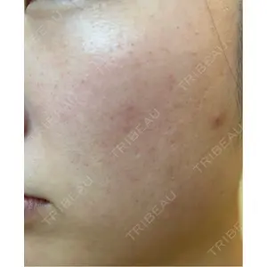 L‘amour clinic Tokyo【ラムールクリニック東京】口コミ