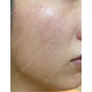 L‘amour clinic Tokyo【ラムールクリニック東京】口コミ