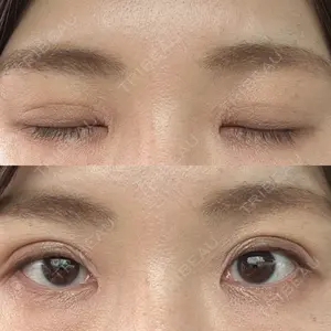 湘南美容クリニック 湘南美容クリニック 千葉センシティ院口コミ