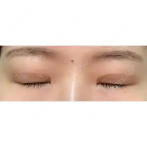 LUHO（ルホ）美容外科口コミ