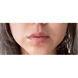 Kinshicho Beauty Clinic （錦糸町ビューティークリニック）口コミ