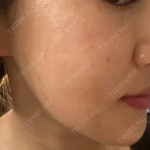 PRO CLINIC プロクリニック 銀座院口コミ