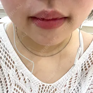 口コミ